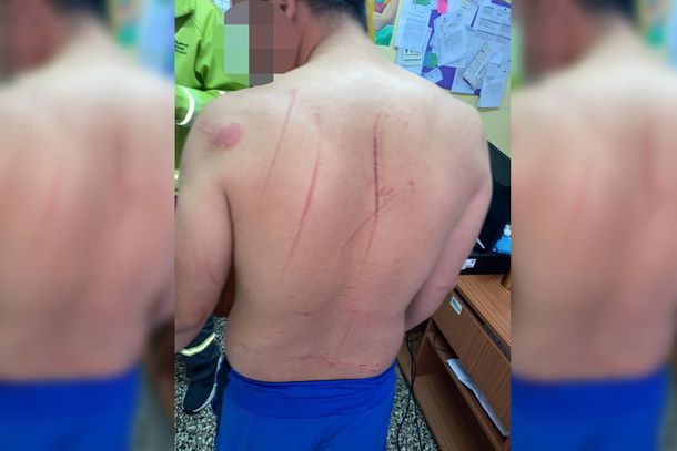 Convivencia en cuarentena: una pelea de pareja terminó con un hombre herido y semidesnudo en la comisaría