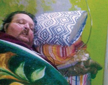 José Fernando Kusnierczyk es obeso mórbido