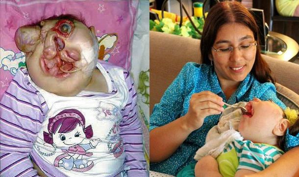 Vitória pasó por ocho operaciones para darle un rostro