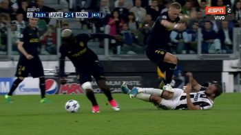 el tremendo pisoton que sufrio gonzalo higuain ante monaco el tremendo pisoton que sufrio gonzalo higuain ante monaco