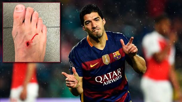 Así le dejó el pie Luis Suarez a Filipe Luis: El fútbol es para hombres