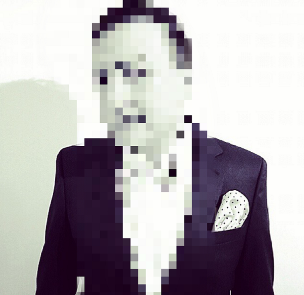 El cambio de rostro de un famoso cantante: lipoescultura facial y retoque en la nariz