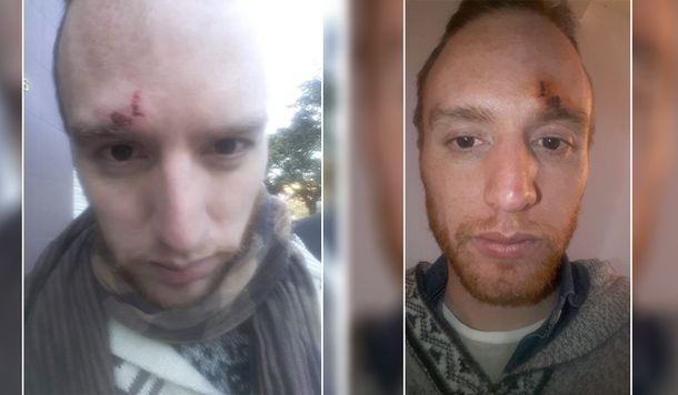 La Plata: brutal agresión a un hombre por ser gay