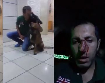 Le quiso dar un beso al perro y terminó con la cara mordida