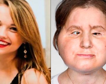 El antes y después de Katie