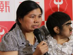 una nina tiene exceso de vello por extrana enfermedad una nina tiene exceso de vello por extrana enfermedad