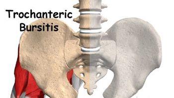 que es la bursitis trocanterea que le diagnosticaron a la presidenta cristina kirchner que es la bursitis trocanterea que le diagnosticaron a la presidenta cristina kirchner