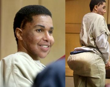 Condenan a una falsa médica por inyectarles cemento a sus pacientes