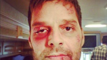 la impactante imagen de ricky martin la impactante imagen de ricky martin