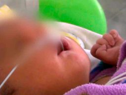 conmocion en peru por el nacimiento de un bebe con dos narices conmocion en peru por el nacimiento de un bebe con dos narices