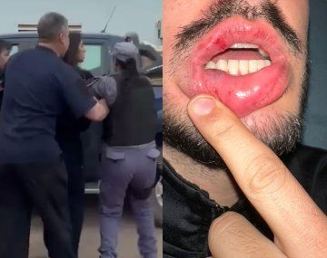Chaco: un comisario borracho agredió a un grupo de médicos voluntarios
