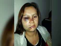 Le desfiguró la cara a golpes con su bebé en brazos: Iba a matarme