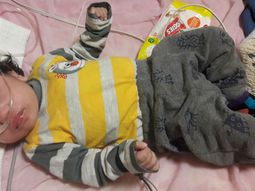 Noah tiene once meses y desde abril está internado Noah tiene once meses y desde abril está internado