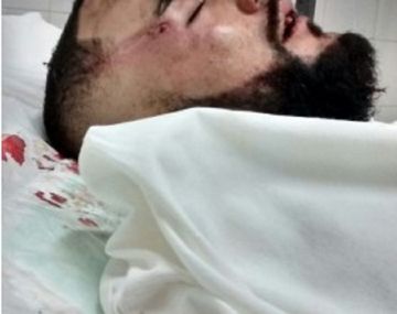 Un joven fue brutalmente golpeado por patovicas en un boliche de Provincia