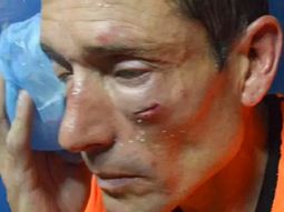 El árbitro tras el ataque El árbitro tras el ataque