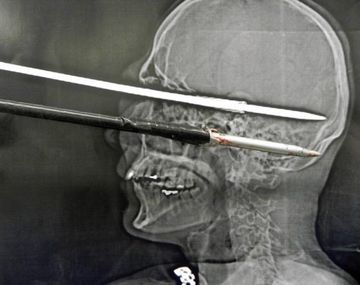 El hombre se salvó de milagro