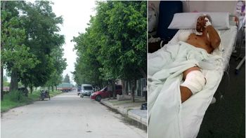 El delincuente amputado será detenido una vez que se recupere El delincuente amputado será detenido una vez que se recupere