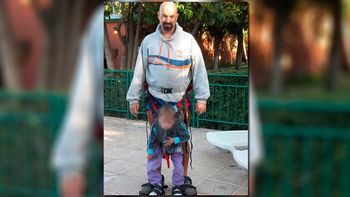 le robaron el arnes que usa su hija cuadriplejica y pide ayuda por facebook le robaron el arnes que usa su hija cuadriplejica y pide ayuda por facebook