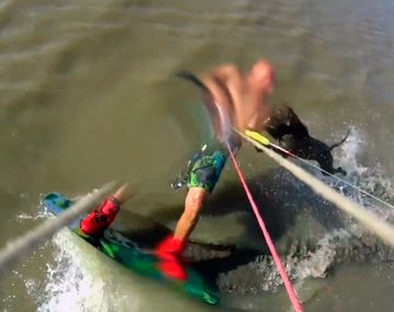 Brutal ataque de un pitbull a un kitesurfista: casi le destroza un brazo