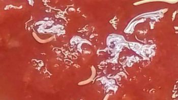 la advertencia de anmat por un lote de un alimento contaminado con gusanos: los detalles la advertencia de anmat por un lote de un alimento contaminado con gusanos: los detalles