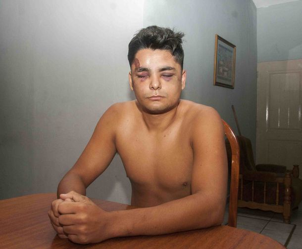 Claudio Torres Brizuela fue salvajemente golpeado por la policía