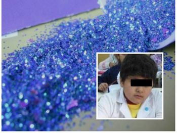 El chico que aspiró purpurina abrió los ojos