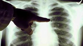 pronostican mas enfermedades pulmonares por el calentamiento global pronostican mas enfermedades pulmonares por el calentamiento global