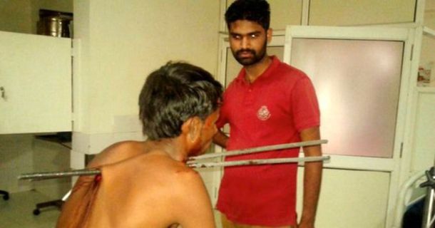 Lo atravesaron dos barras de hierro y sobrevivió