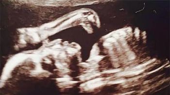 encuentran un dinosaurio en una ecografia de bebe encuentran un dinosaurio en una ecografia de bebe