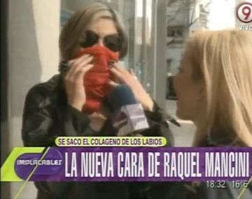 Raquel Mancini no quiere mostrar su labio