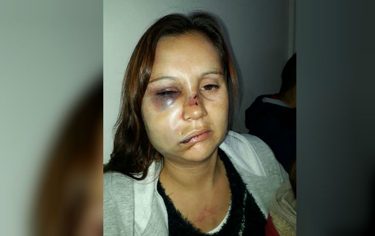 Le desfiguró la cara a golpes con su bebé en brazos: Iba a matarme