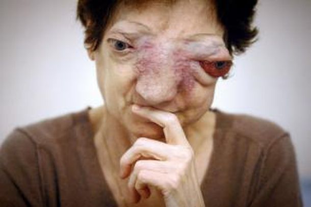 Chantal sebire 20minutos.es