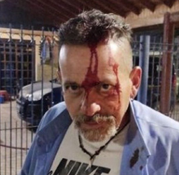 Paro de colectivos en tres líneas por brutal agresión a chofer