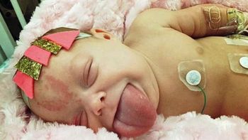 Paisley Morrison-Johnson, niña con lengua gigante Paisley Morrison-Johnson, niña con lengua gigante