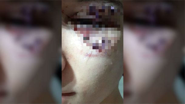 Un rugbier molió a golpes a otro chico porque lo empujó sin querer en un boliche
