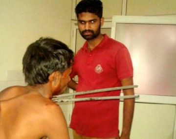 Lo atravesaron dos barras de hierro y sobrevivió