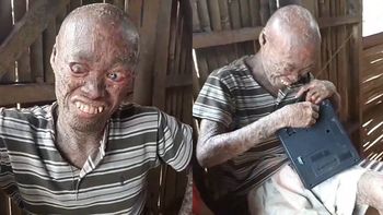 Reloj tiene 26 años y sufre esta condición desde los 12 Reloj tiene 26 años y sufre esta condición desde los 12