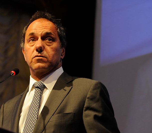 ¿Qué es el miembro fantasma, el síndrome al que se refirió Scioli?