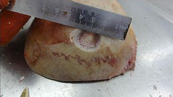 cirugias cerebrales hace 2.300 anos cirugias cerebrales hace 2.300 anos