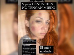 preocupacion por lourdes de bandana: mostro su cara golpeada en las redes sociales preocupacion por lourdes de bandana: mostro su cara golpeada en las redes sociales