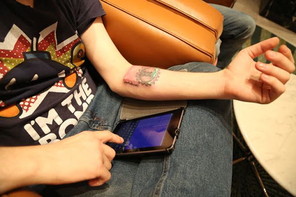 Biohacker se injerta un chip del tamaño de un celular en un brazo