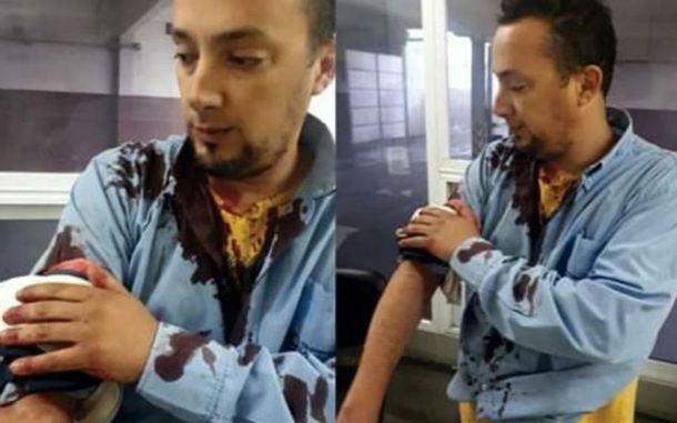 Otro ataque a un colectivero: lo apuñalaron con una trincheta en Moreno
