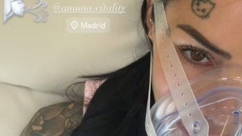 Qué es la terapia de hipoxia, el tratamiento que promociona Cande Tinelli