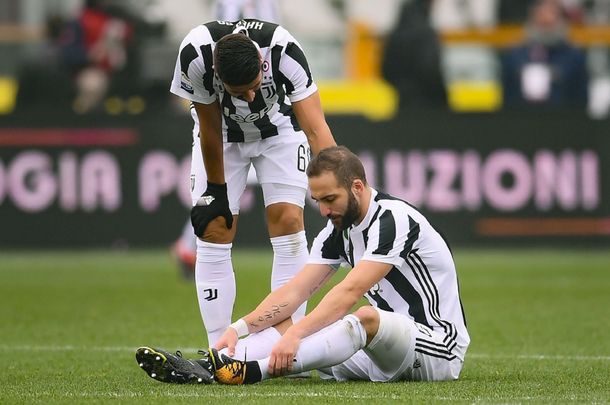 Gonzalo Higuaín se fue lesionado en el derby de Turín.