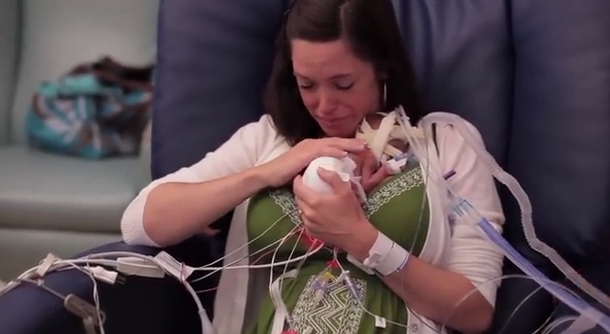 VIDEO: Un bebé prematuro es furor en Internet y conmueve al mundo