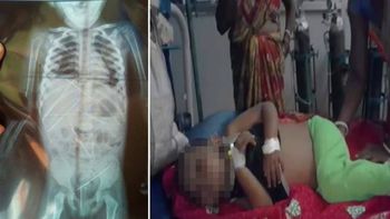 La niña fue abusada sexualmente y usada como muñeca vudú La niña fue abusada sexualmente y usada como muñeca vudú