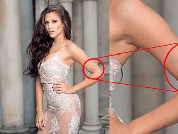 Barbie mostró un moretón en una producción