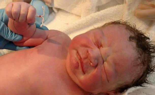 El bebe nació con el DIU en la mano