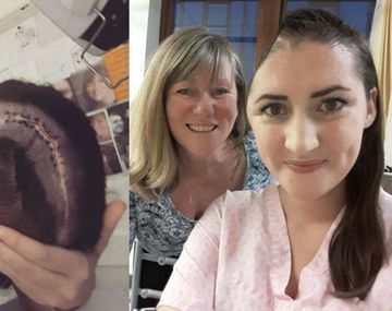 Francesca sufrió un derrame el año pasado