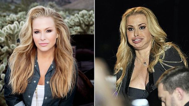 ¿Qué le pasó en la cara a Anastacia?